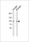 CDH20 Antibody (N-term)